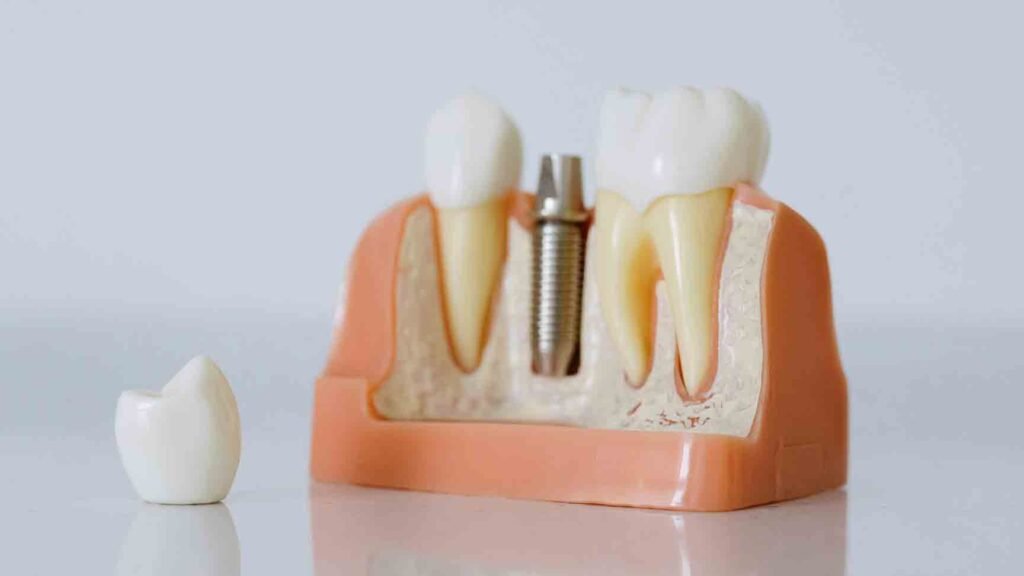 The Grange Quick and Fast Solutions - Removables and fix dentures