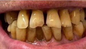 The Grange - Cases 5