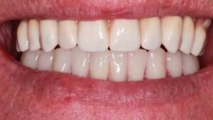 The Grange - Cases 6