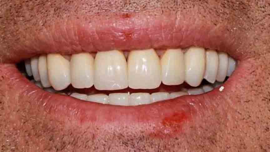 The Grange - Cases 7