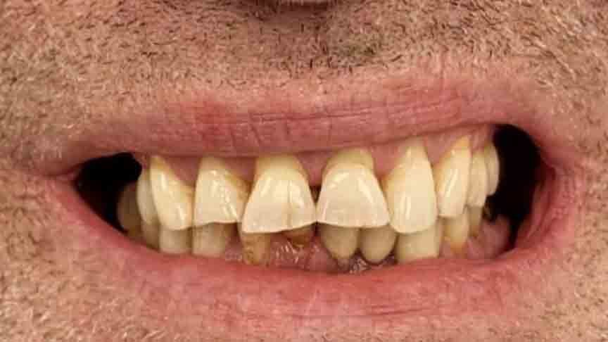 The Grange - Cases 8