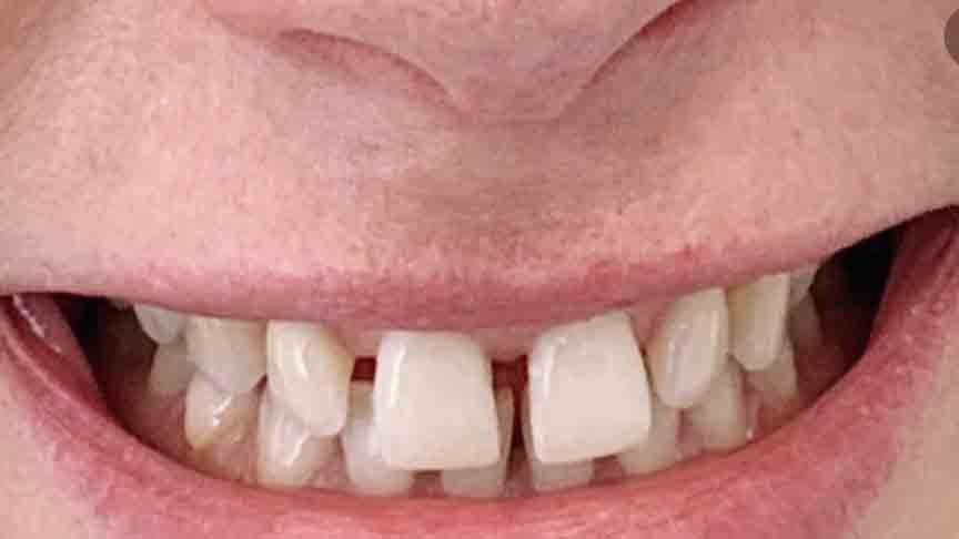 The Grange - Cases 9