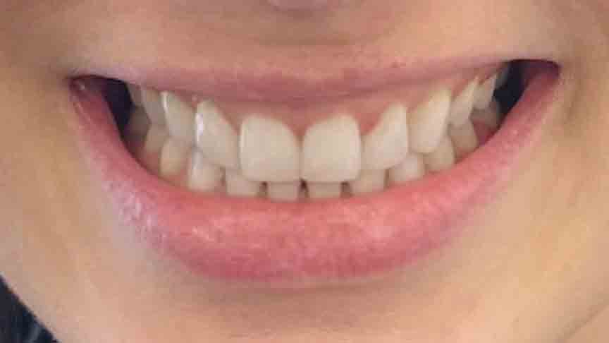 The Grange - Cases 10