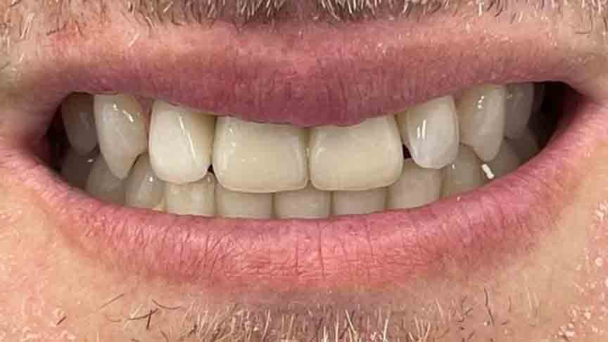 The Grange - Cases 12